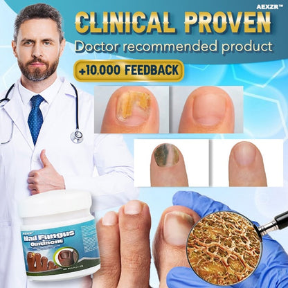 ✨🇬🇧Aexzr™ 5X Quick-healing Nail Fungus Ointment👨🏼‍⚕️British Dermatologist Approved