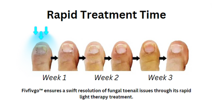 Fivfivgo™ Revolutionary Light Therapy Device For Toenail Diseases