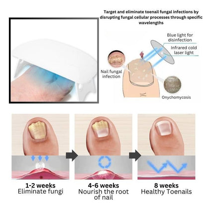 Fivfivgo™ Revolutionary Light Therapy Device For Toenail Diseases